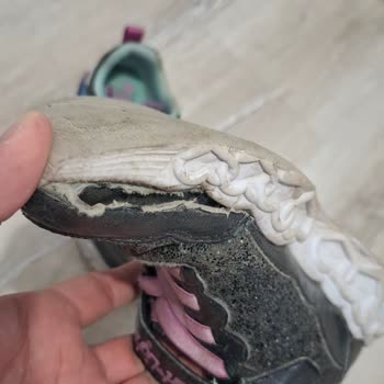 Kısa Sürede Hasar Gören Skechers Ayakkabıya Çözüm Bulunmadı