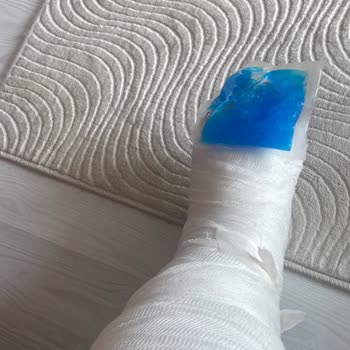 Metro İstasyonundaki Çukur Nedeniyle Yaşanan Kaza Ve Mağduriyet