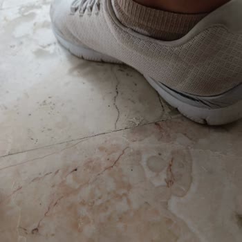 Kısa Sürede Deforme Olan Ayakkabı Ve İlgisiz Müşteri Hizmetleri Hayal Kırıklığı