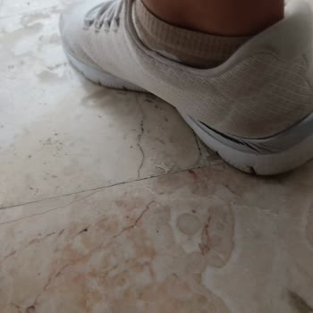 Kısa Sürede Deforme Olan Ayakkabı Ve İlgisiz Müşteri Hizmetleri Hayal Kırıklığı