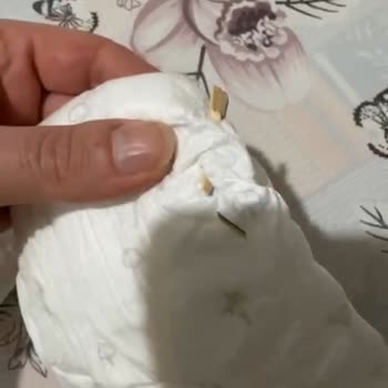 Bebek Bezinden Çıkan Tahta Parçası Şoku