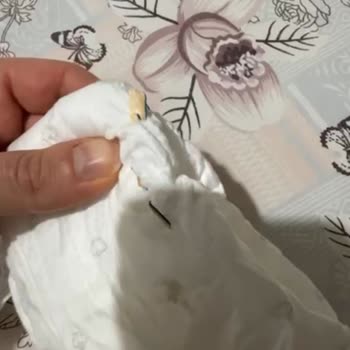 Bebek Bezinden Çıkan Tahta Parçası Şoku