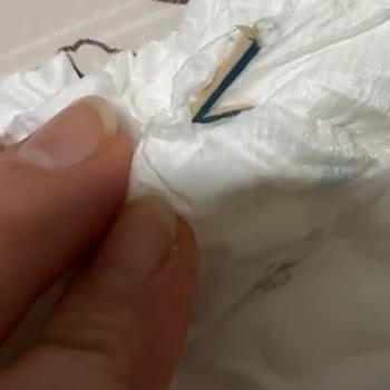 Bebek Bezinden Çıkan Tahta Parçası Şoku