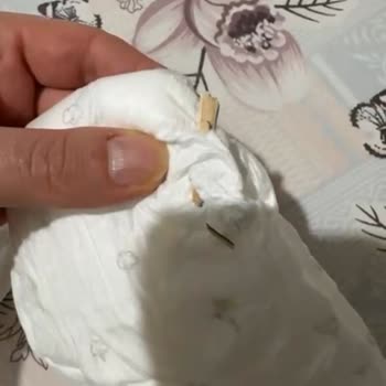 Bebek Bezinden Çıkan Tahta Parçası Şoku