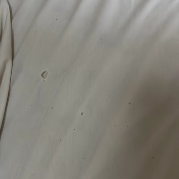 Kötü Hijyen Ve Kullanılamaz Oda Nedeniyle Ücret İadesi Talebi