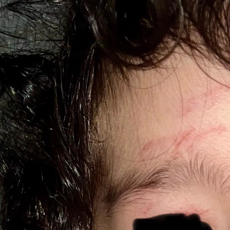 Migros Vega AVM'de Güvensiz Alışveriş Sepeti Nedeniyle Çocuğum Yaralandı