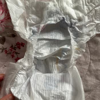 Molfix Bebek Bezi Yerine Kağıt Çıktı, Müşteri Hizmetleri Sessiz Kaldı