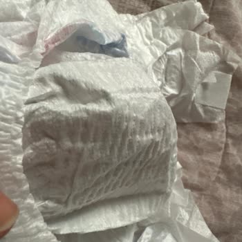 Molfix Bebek Bezi Yerine Kağıt Çıktı, Müşteri Hizmetleri Sessiz Kaldı