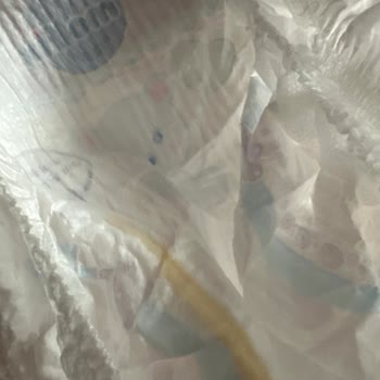 Molfix Bebek Bezi Yerine Kağıt Çıktı, Müşteri Hizmetleri Sessiz Kaldı