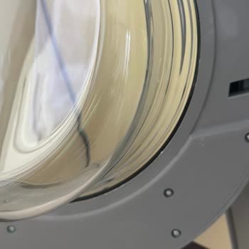 Servis Sonrası Çizikli Ve Hatalı Kapak Montajı Nedeniyle Çamaşır Makinem Çalışmıyor