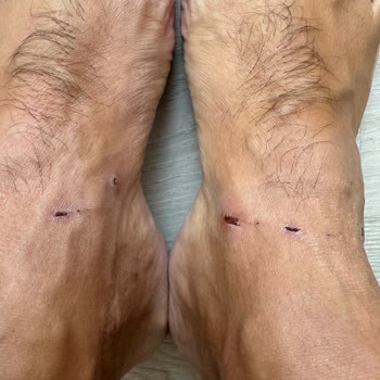 Nautica Terlik Bantları Ayaklarımı Kesti, İade Reddedildi