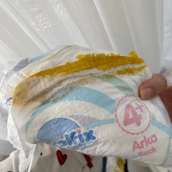 Molfix 4+ Bebek Bezlerinde Sürekli Sızdırma Sorunu