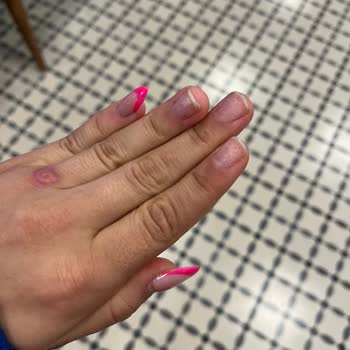 Mabel Güzellik Merkezi Yapılan İşlemden Memnun Kalmadım!