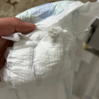 Bebek Bezinde Küf Sorunu Nedeniyle Endişe Ve Mağduriyet Yaşadım