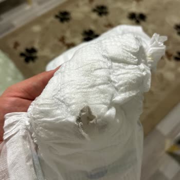 Bebek Bezinde Küf Sorunu Nedeniyle Endişe Ve Mağduriyet Yaşadım