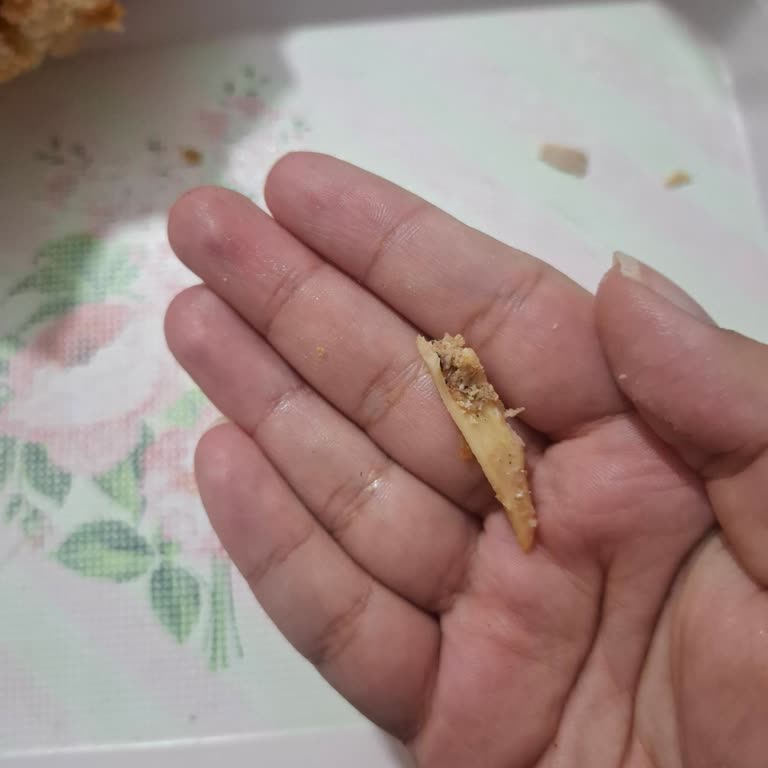 Tavuk Dönerin İçinden Çıkan Kemik Parçası Endişe Yarattı