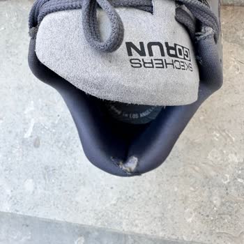 Skechers Ayakkabıda Erken Yıpranma Ve Garanti Reddi Mağduriyeti