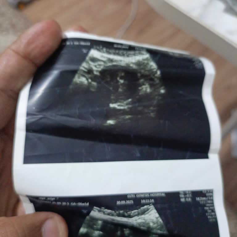 Hatalı Müdahale Sonrası Bebeğimizi Kaybettik, Sorumluların Araştırılmasını İstiyoruz