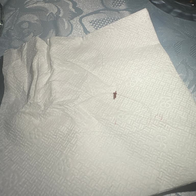 Aldığım Pastadan Kıl Çıktı, Hijyen Konusunda Hayal Kırıklığı Yaşadım