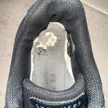 Satın Aldığım Ayakkabıda Taban Açılması Ve Yetersiz İnceleme Süreci