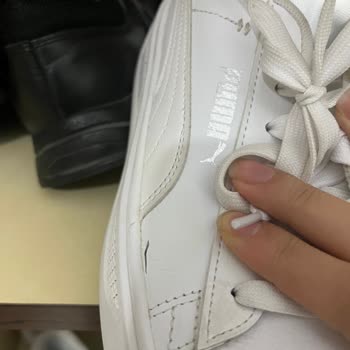 5 Ayda Deforme Olan Ayakkabıya İlgisiz Yaklaşım Mağduriyetimi Artırdı