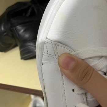 5 Ayda Deforme Olan Ayakkabıya İlgisiz Yaklaşım Mağduriyetimi Artırdı