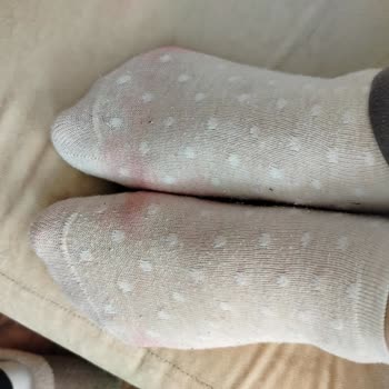 Ceyo Terlikten Ciddi Boya Verme Ve Leke Sorunu