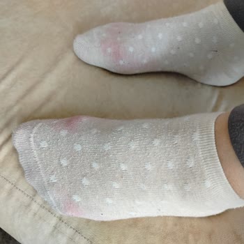 Ceyo Terlikten Ciddi Boya Verme Ve Leke Sorunu