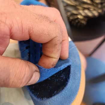 Adidas Ayakkabı Kısa Sürede Yırtıldı, Mağaza Çözüm Sunmadı