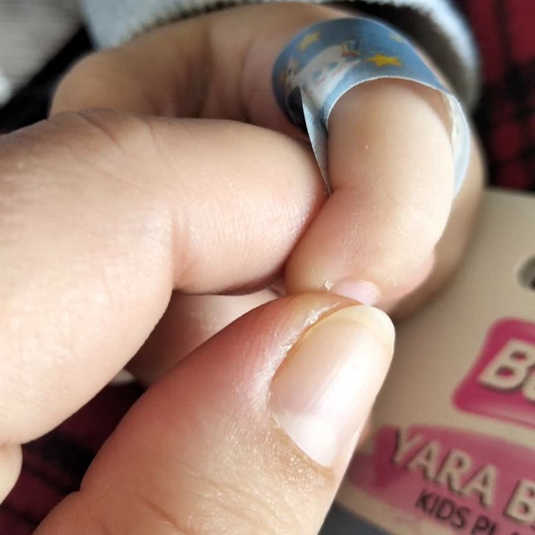 Benri Çocuk Yara Bandı Yapışmıyor, Mağduriyet Yaşıyorum