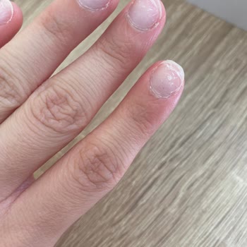 Jel Tırnak İşlemi Sonrası Tırnaklarım Zarar Gördü, Ücret İadesi İstiyorum