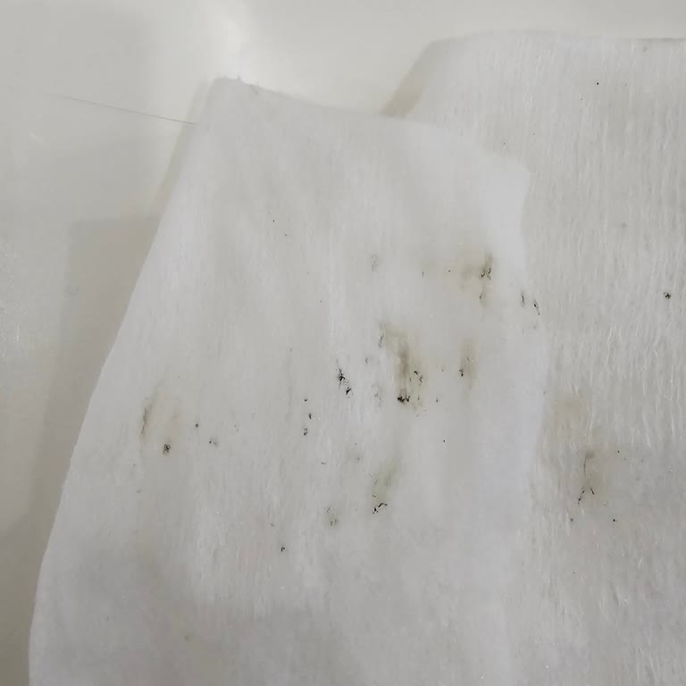 Yenidoğan Islak Mendilde Küf Benzeri Lekeler Endişelendirdi