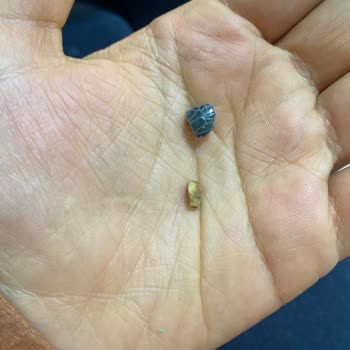 Çocuğumun Hayatını Riske Atan Üründe Taş Çıkması