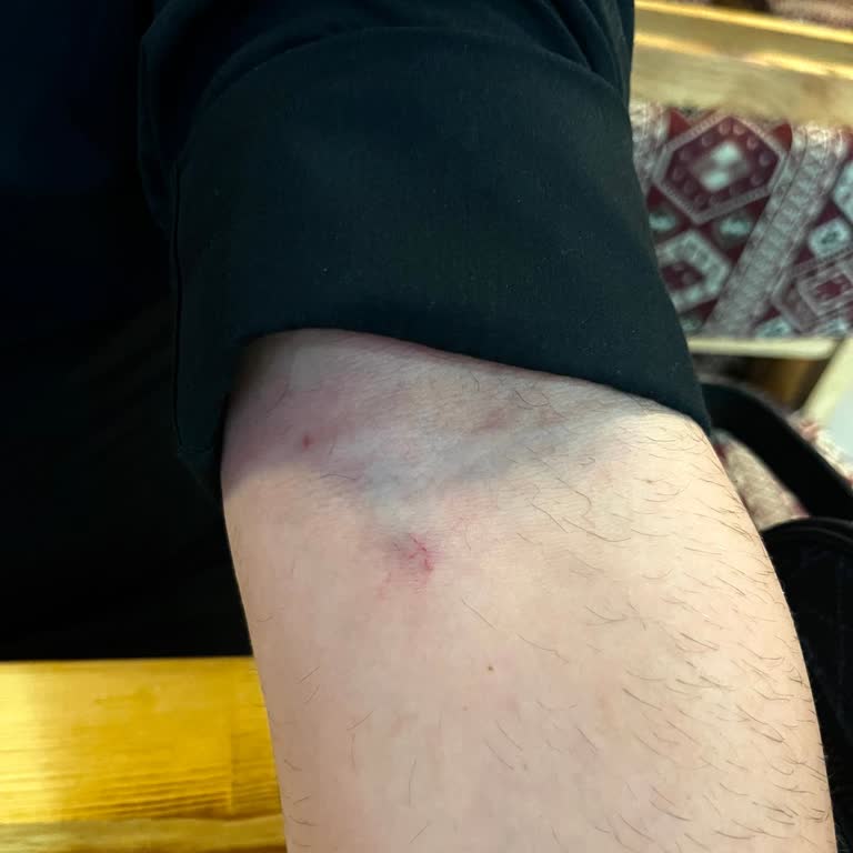 Yanlış Uygulama Ve İlgisiz Tavır Nedeniyle Sağlığımız Tehlikeye Girdi