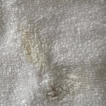 Siparişimdeki Havlular Hijyenik Değildi, Sağlığımız Tehlikeye Atıldı