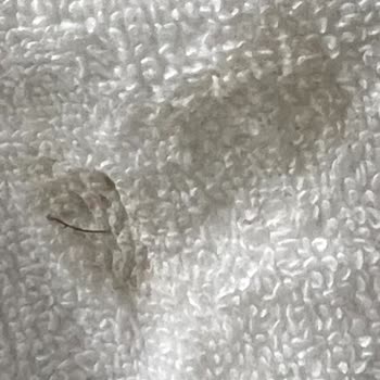 Siparişimdeki Havlular Hijyenik Değildi, Sağlığımız Tehlikeye Atıldı