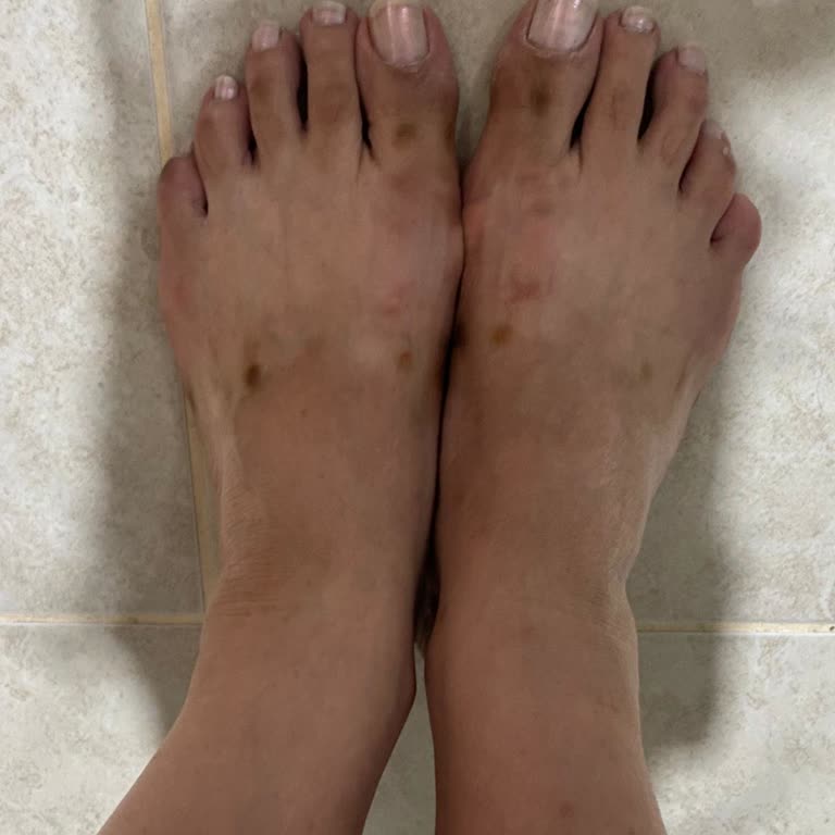 Greyder Terliğin Zımbaları Paslandı Mağaza Çözüm Sunmuyor