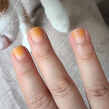 Pastel 421 Numaralı Oje Tırnakta Kalıcı Leke Bıraktı, Mağduriyet Yaşadım