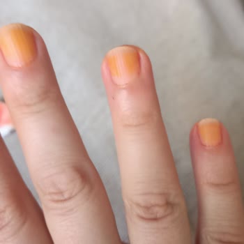 Pastel 421 Numaralı Oje Tırnakta Kalıcı Leke Bıraktı, Mağduriyet Yaşadım