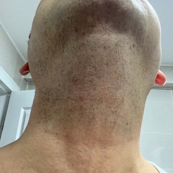 Philips 3000 Series Sakal Tıraş Makinesi Beklentileri Karşılamıyor, Değişim Talebim Var