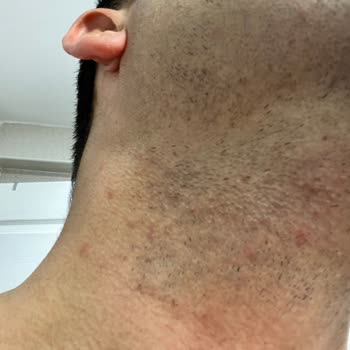 Philips 3000 Series Sakal Tıraş Makinesi Beklentileri Karşılamıyor, Değişim Talebim Var