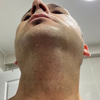 Philips 3000 Series Sakal Tıraş Makinesi Beklentileri Karşılamıyor, Değişim Talebim Var