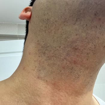 Philips 3000 Series Sakal Tıraş Makinesi Beklentileri Karşılamıyor, Değişim Talebim Var