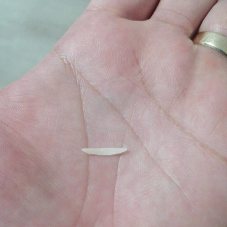 Makarnadan Çıkan Yabancı Madde Çocuğumun Boğazına Takıldı