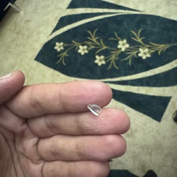 Kazandibinde Cam Parçası Ve İlgisiz Davranış: Sağlığımız Tehlikeye Atıldı