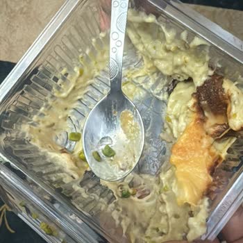 Kazandibinde Cam Parçası Ve İlgisiz Davranış: Sağlığımız Tehlikeye Atıldı