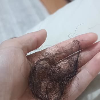 L'Loreal Elseve Şampuan Saç Dökülmesini Artırdı Ve Saçlarımı Cansızlaştırdı