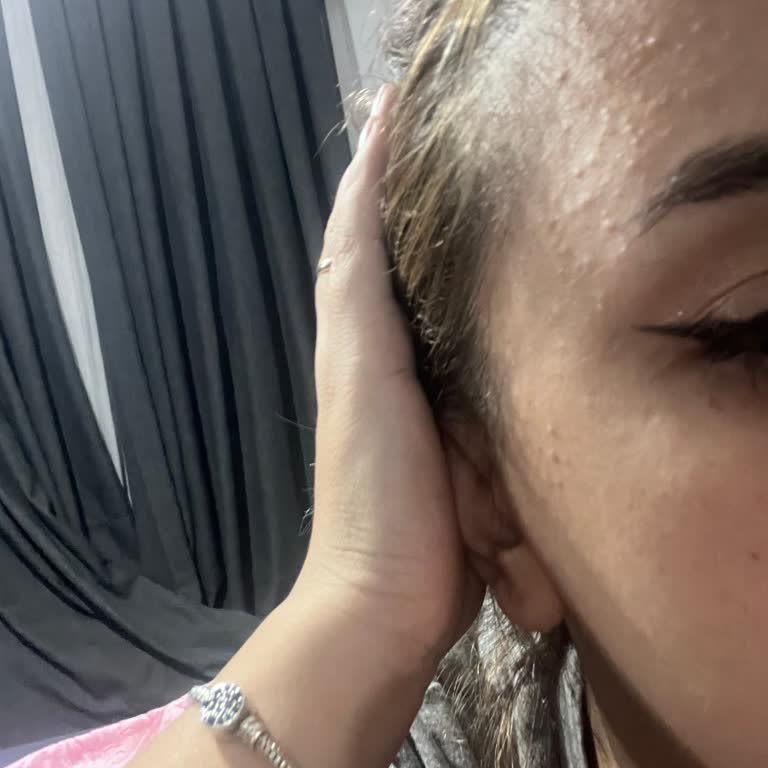 Elidor Şampuan Ciltte Sivilce Ve Kaşıntıya Sebep Oldu