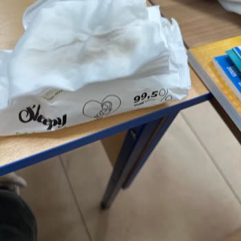 Sleepy Islak Mendillerdeki Siyah İzler Hijyen Endişesi Yarattı