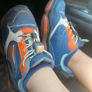 I Face White Chemical Stains On My Child’s Deichmann Shoes From Day One